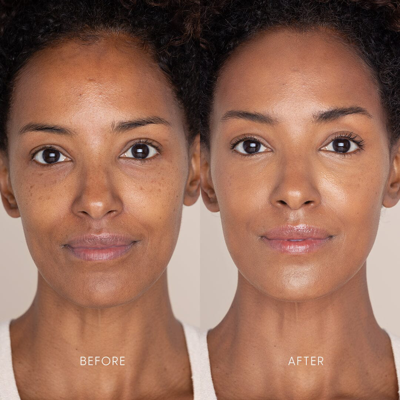 Iris & Romeo Best Skin Days Treatment Concealer