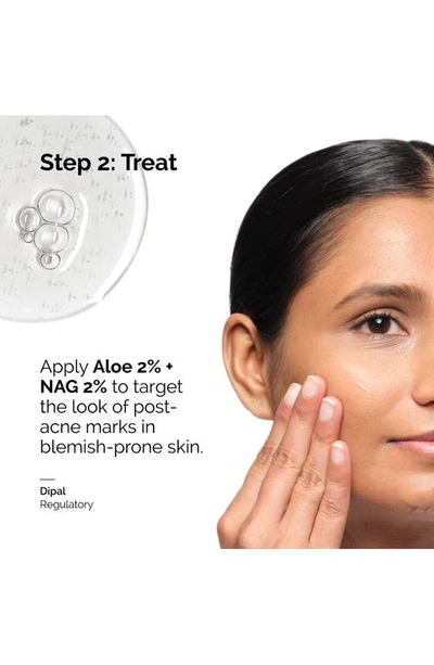 The Ordinary Aloe 2% + Nag 2% Solution 1 oz / 30 ml