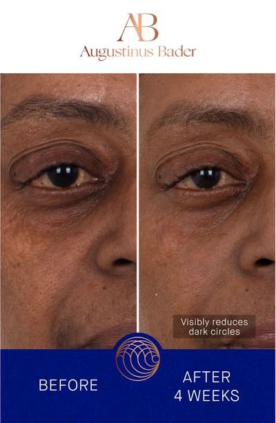 Augustinus Bader The Eye Patches Single