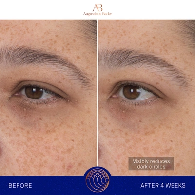 Shop Augustinus Bader The Eye Patches In 1 Treatment