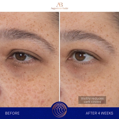 Augustinus Bader The Eye Patches In 6 Treatments