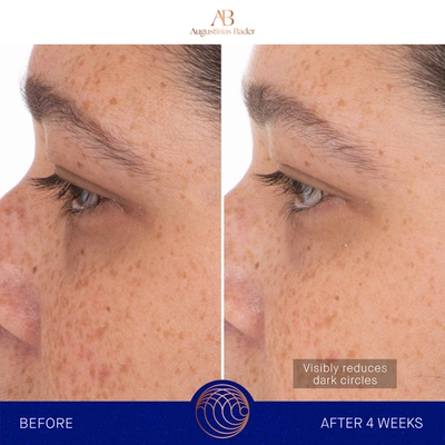 Augustinus Bader The Eye Patches In 6 Treatments