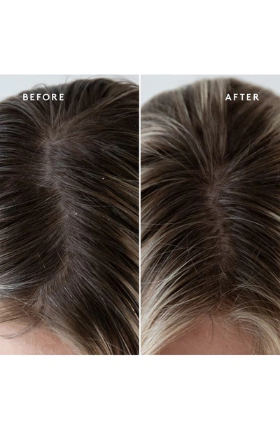 Virtuer Exfoliating Scalp Treatment