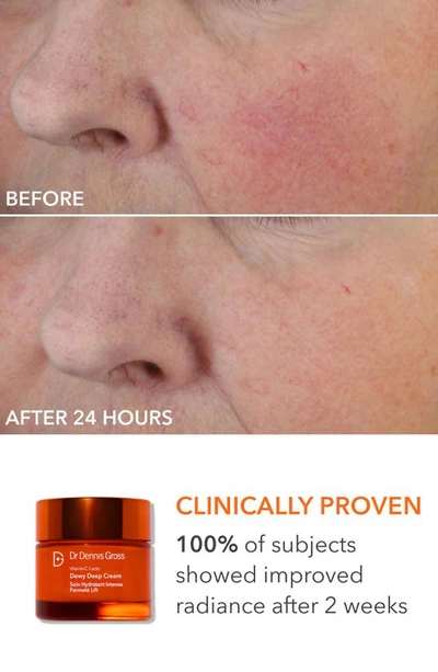 Dr Dennis Gross Skincare Dr. Dennis Gross Skincare Collagen Boosting Essentials Set $641 Value