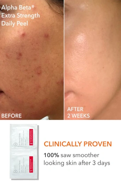 Dr Dennis Gross Skincare Dr. Dennis Gross Skincare Collagen Boosting Essentials Set $641 Value