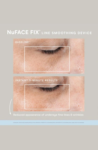 Nuface ® Fix Line Smoothing Device & Serum Set $165 Value