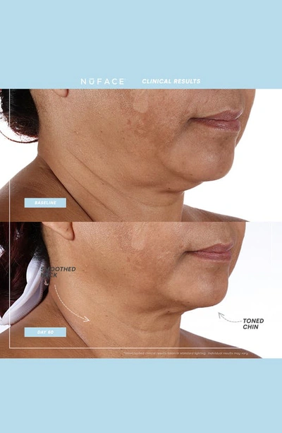 Nuface ® Mini+® Starter Kit $250 Value In Sany Rose