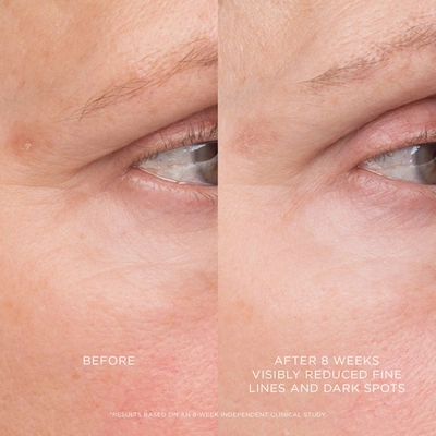 Hourglass Equilibrium Resurfacing Retinoid Treatment In Default Title