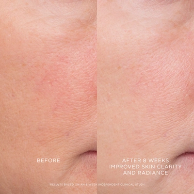 Hourglass Equilibrium Resurfacing Retinoid Treatment In Default Title