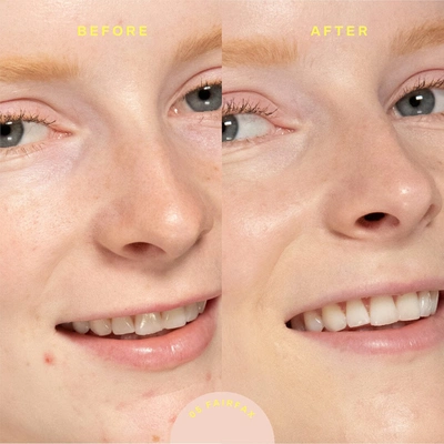 Tower 28 Sunnydays Tinted Spf Sunscreen Foundation