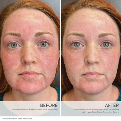 Jane Iredale Hydropure Color Correcting Serum With Hyaluronic Acid And Coq10 In Default Title