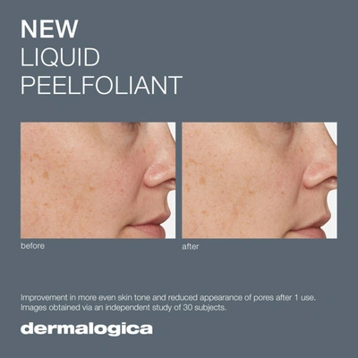 Dermalogica Liquid Peelfoliant In Default Title
