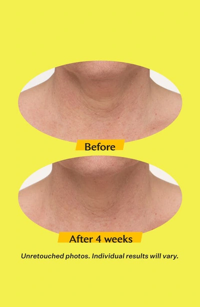 Strivectin Tl Advanced Tightening Neck Cream Light, 1.7 Oz.