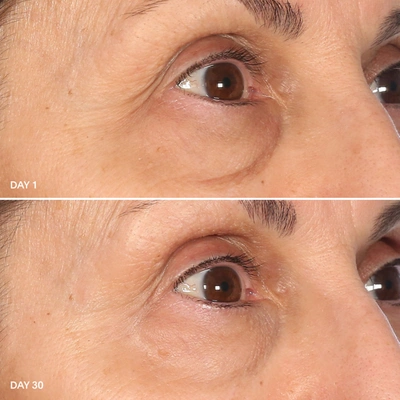 U Beauty The Return Eye Concentrate In Default Title