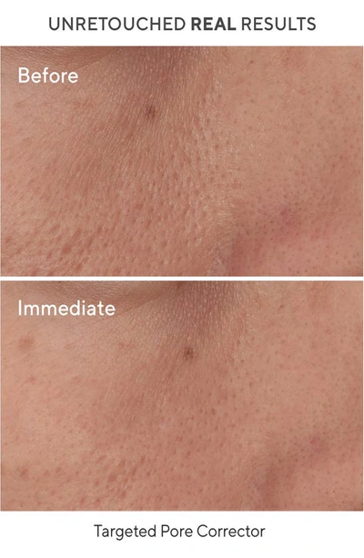 Murad The Glow Infusers Set (limited Edition) $41 Value, 0.5 oz