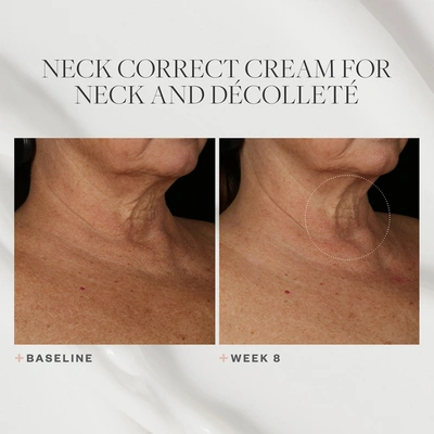 Skinmedica Neck Correct Cream In Default Title