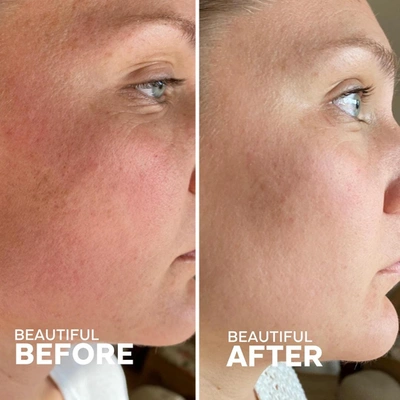 Three Ships Skin Hero Bakuchiol + Calendula Bio-retinol Serum