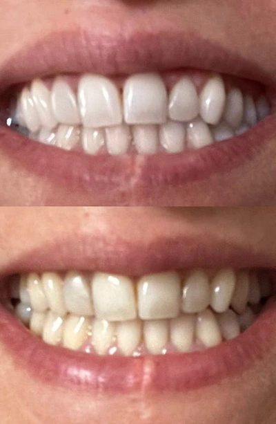 Snow Advanced Whitening Led Toothbrush In Black