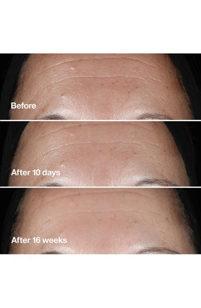Clinique Smart Clinical Repair™ Wrinkle Correcting Serum