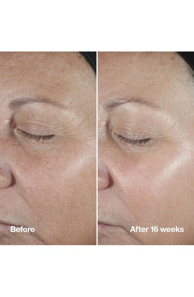 Clinique Smart Clinical Repair™ Wrinkle Correcting Serum
