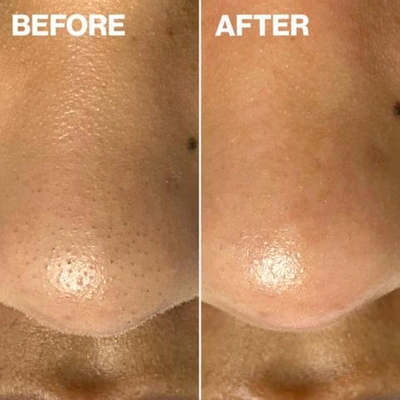 Dermaflash Dermapore+ Blush In Default Title