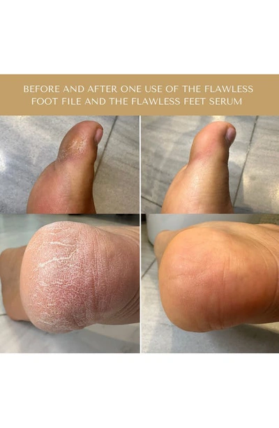 Serum Doctor Flawless Feet Serum In Green