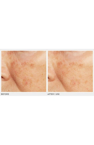 Lancer Skincare Caviar Lime Acid Peel With Glycolic Acid 10 Phytic Acid 10 Retinol (1.7 Oz.)