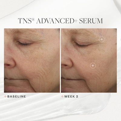 Skinmedica Tns Advanced+ Serum In Default Title