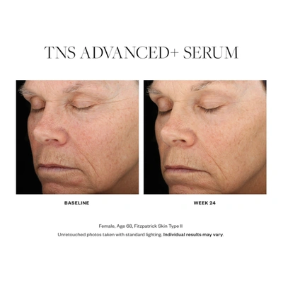 Shop Skinmedica Tns Advanced+ Serum In Default Title