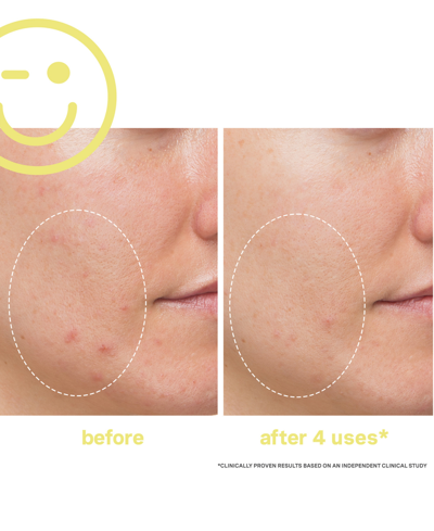 Kate Somerville Mega-c 30% Vitamin C Brightening Mask 2 oz / 60 ml In No Color
