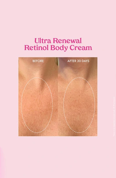 Kopari Ultra Renewal Retinol Body Cream
