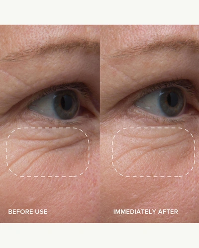 Alpyn Beauty Plantgenius Line-filling Eye Balm With Bakuchiol