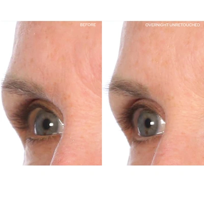 Sio Browlift In Default Title