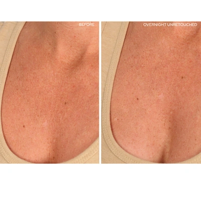 Shop Sio Chestlift In 2 Treatments