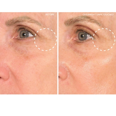 Shop Sio Eye And Smile Lift In 1 Treatment