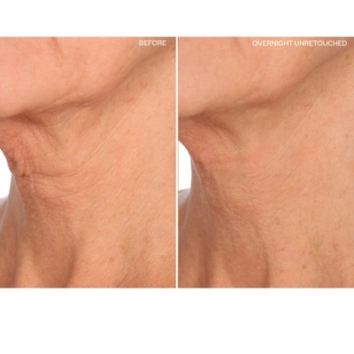 Sio Facelift In Default Title