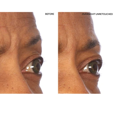 Sio Superlift Pack In Default Title