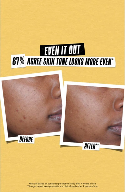 Kiehl's Since 1851 Better Screen Uv Serum