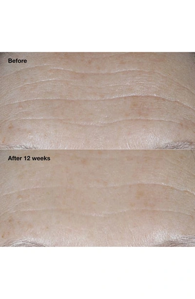 Clinique Smart Clinical Repair Broad Spectrum Spf 30 Wrinkle Correcting Face Cream