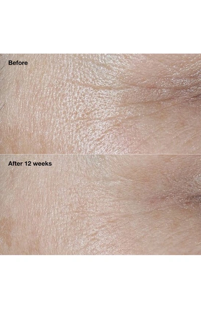 Clinique Smart Clinical Repair Broad Spectrum Spf 30 Wrinkle Correcting Face Cream