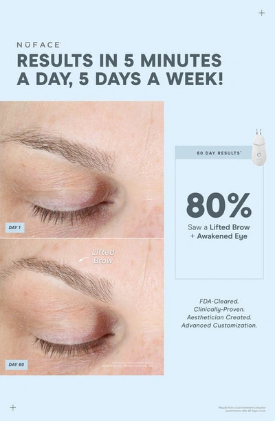 Nuface Trinity+ And Effective Lip And Eye Attachment