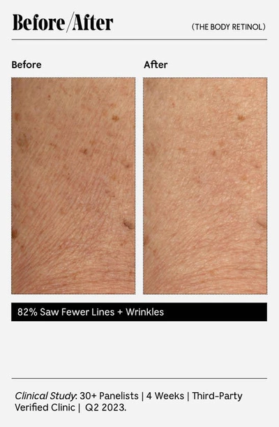 Necessaire The Body Retinol - Repair Serum With 0.1% Pure Retinol, 10% Aha + 5 Peptides 5.1 oz / 150 ml