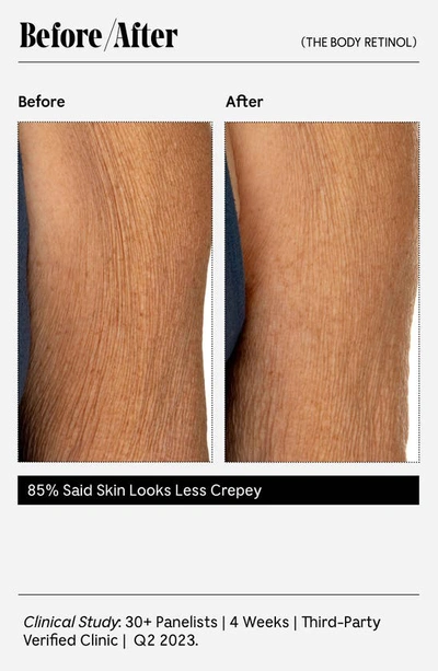 Necessaire The Body Retinol - Repair Serum With 0.1% Pure Retinol, 10% Aha + 5 Peptides 5.1 oz / 150 ml