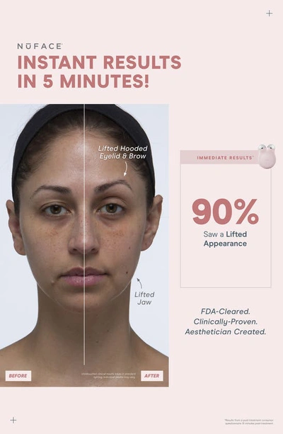 Nuface ® Mini+ On-the-go Facial Toning Starter Kit $309 Value In Midnight Black