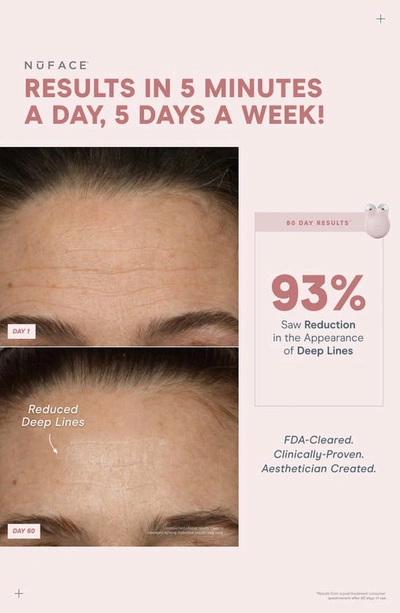 Nuface ® Mini+ On-the-go Facial Toning Starter Kit $309 Value In Midnight Black
