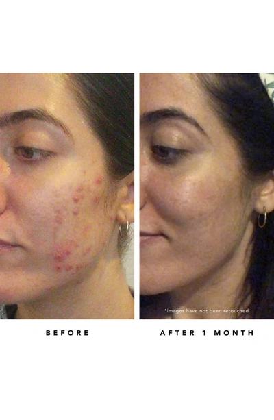 Herbivore Botanicals Blue Tansy Bha + Enzyme Pore Refining Mask