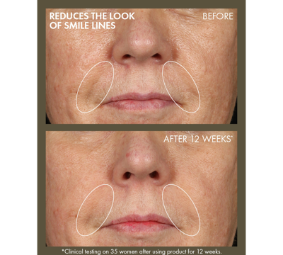 Origins Plantscription Active Wrinkle Correction Serum In No Color