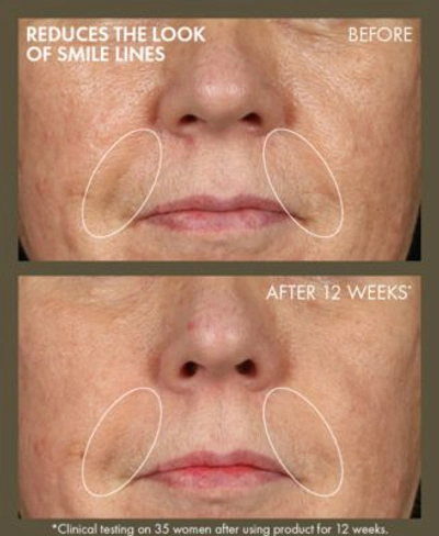 Origins Plantscription Active Wrinkle Correction Serum In No Color