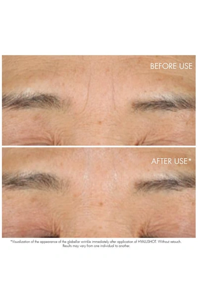 Dior Capture Totale Hyalushot: Wrinkle Corrector With Hyaluronic Acid