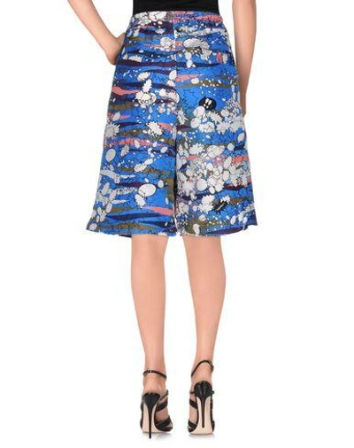 Shop Golden Goose Bermudas In Blue